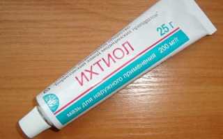 Ихтиол при фурункуле: эффект от лечения и схема применения